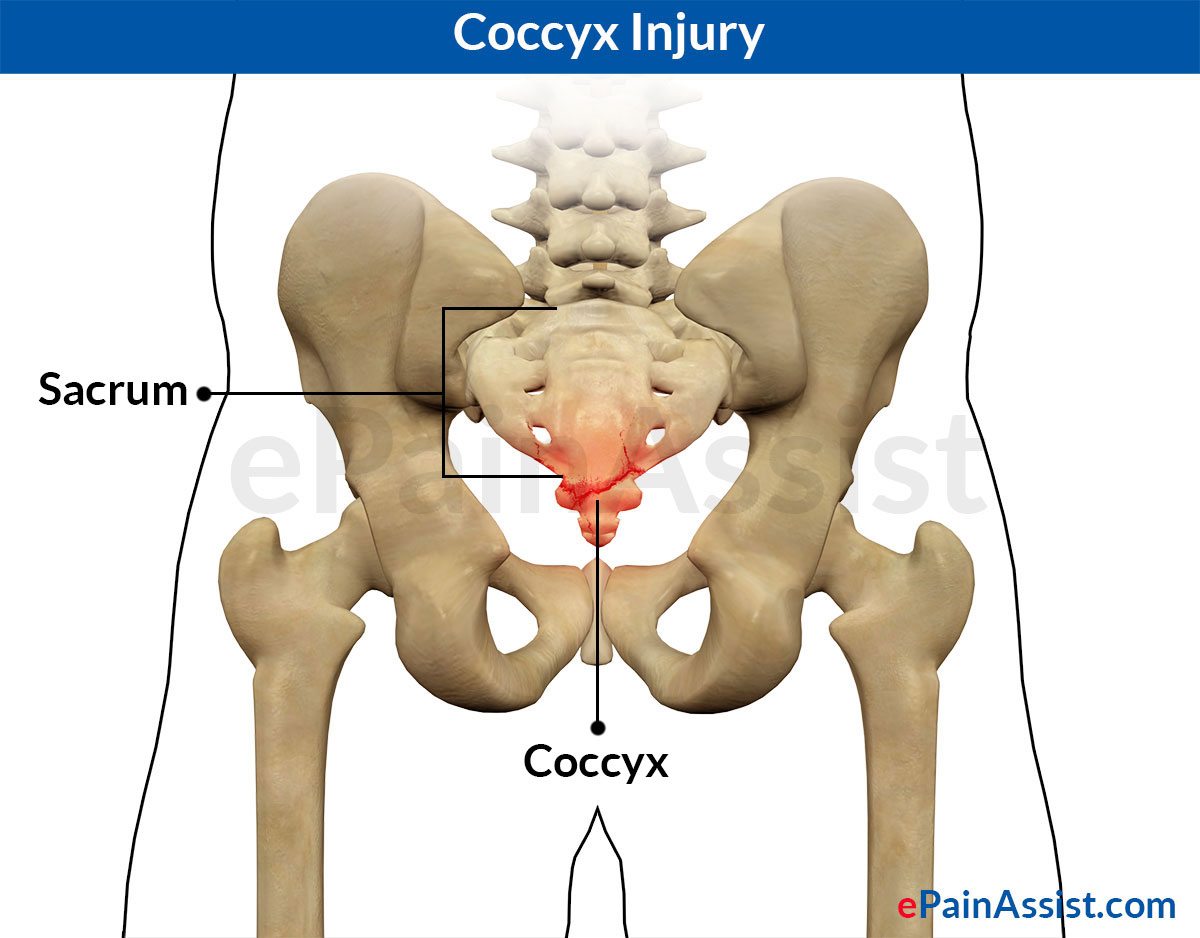 Coccyx Injury