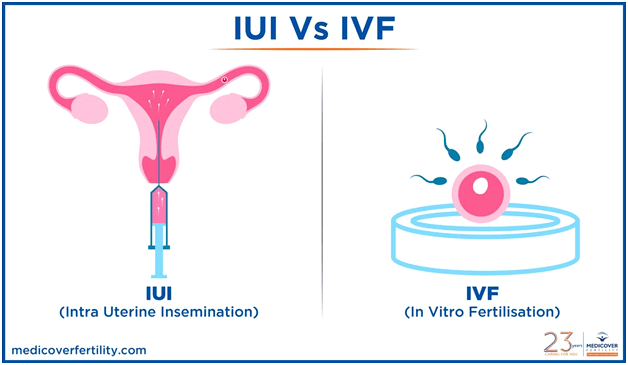 IUI – A BETTER OPTION OF HAVING A BABY TO CHILDLESS COUPLE